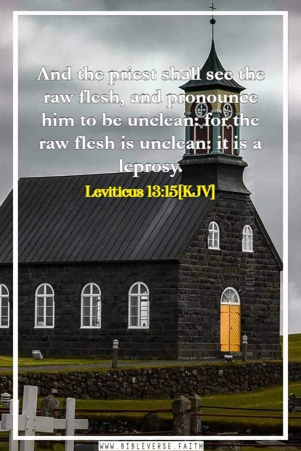 leviticus 13 15[kjv] the leper in the bible